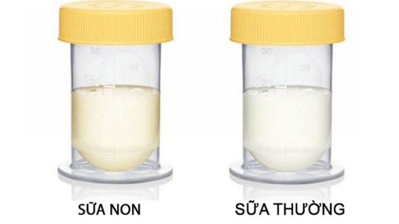 Sữa non là gì và lợi ích khi kết hợp với sữa mẹ
